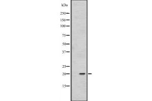 Western blot analysis of FAIM1 expression in 293T whole cell lysate ,The lane on the left is treated with the antigen-specific peptide.