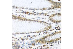 Immunohistochemistry of paraffin-embedded human stomach using IFI44 antibody at dilution of 1:100 (40x lens). (IFI44 antibody)