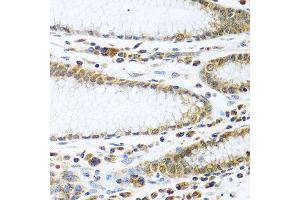 Immunohistochemistry of paraffin-embedded human stomach using IFI44 antibody at dilution of 1:100 (40x lens).