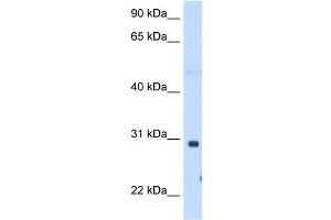ST3GAL3 antibody used at 1. (ST3GAL3 antibody  (C-Term))