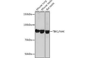 Western blot analysis of extracts of various cell lines, using TBK1/NAK Rabbit mAb (ABIN7270723) at 1:1000 dilution. (TBK1 antibody)