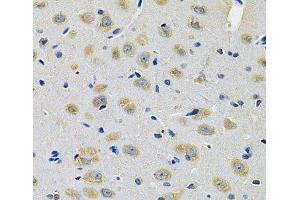 Immunohistochemistry of paraffin-embedded Rat brain using TXNDC5 Polyclonal Antibody at dilution of 1:100 (40x lens). (TXNDC5 antibody)