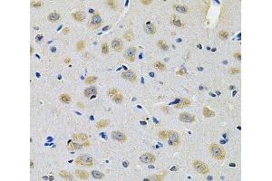 Immunohistochemistry of paraffin-embedded Rat brain using TXNDC5 Polyclonal Antibody at dilution of 1:100 (40x lens).