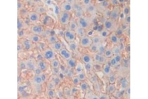 Figure. (NUMB antibody  (AA 376-482))