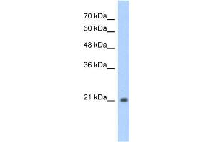 WB Suggested Anti-TSHR Antibody Titration:  1. (TSH receptor antibody  (N-Term))