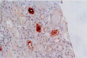Immunohistochemistry staining of kidney allograft biopsy (paraffin-embedded sections) with anti-human HLA-G (MEM-G/2). (HLAG antibody)