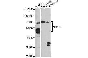 Western blot analysis of extracts of various cell lines, using MMP14 antibody. (MMP14 antibody)