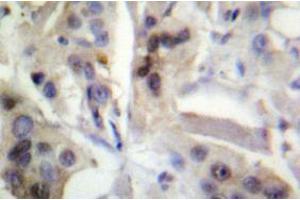 Image no. 2 for anti-Nuclear Factor-kB p65 (NFkBP65) antibody (ABIN317854) (NF-kB p65 antibody)