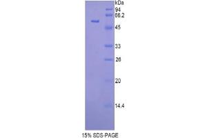 SDS-PAGE analysis of Mouse Glucosidase beta , Acid Protein. (GBA Protein)