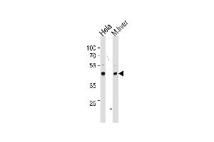 TBX6 Antibody (Center ) (ABIN655621 and ABIN2845101) western blot analysis in Hela cell line and mouse liver tissue lysates (35 μg/lane). (T-Box 6 antibody  (AA 143-172))