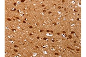 The image on the left is immunohistochemistry of paraffin-embedded Human brain tissue using ABIN7130740(PSMD3 Antibody) at dilution 1/25, on the right is treated with fusion protein. (PSMD3 antibody)