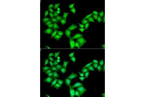 Immunofluorescence analysis of HeLa cells using AAAS antibody (ABIN5973827).