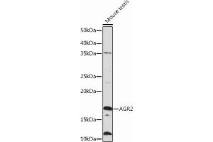 Western blot analysis of extracts of Mouse testis, using  Rabbit mAb (ABIN6134271, ABIN6138179, ABIN6138182 and ABIN7101399) at 1:1000 dilution. (AGR2 antibody)