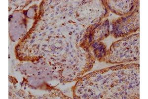 IHC image of ABIN7127339 diluted at 1:100 and staining in paraffin-embedded human placenta tissue performed on a Leica BondTM system. (Recombinant Angiopoietin 2 antibody)