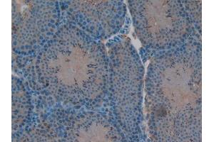 IHC-P analysis of Mouse Testis Tissue, with DAB staining. (RELB antibody  (AA 176-436))