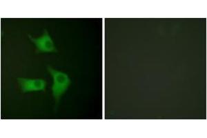 Immunofluorescence analysis of HeLa cells, using p15 INK Antibody. (CDKN2B antibody  (AA 89-138))
