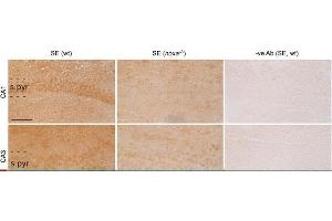 Noxa immunostaining in seizure-damaged hippocampi from wt and Noxa-deficient mice. (NOXA antibody)
