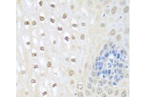 Immunohistochemistry of paraffin-embedded Human esophagus using NEDD8 Polyclonal Antibody at dilution of 1:100 (40x lens). (NEDD8 antibody)