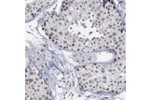 Immunohistochemical staining of human testis with BRD1 polyclonal antibody  shows moderate nuclear positivity in seminiferus ducts. (BRD1 antibody)