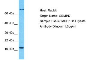 Host: Rabbit Target Name: GEMIN7 Sample Type: MCF7 Whole Cell lysates Antibody Dilution: 1.