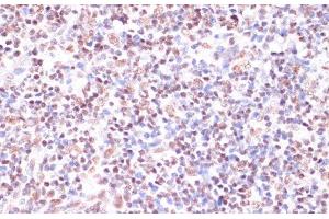 Immunohistochemistry of paraffin-embedded Human lymph node using CREB1 Polyclonal Antibody at dilution of 1:100 (40x lens). (CREB1 antibody)