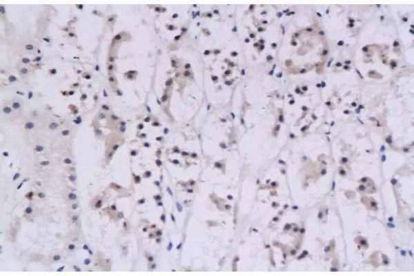 Interferon gamma antibody  (AA 81-166)