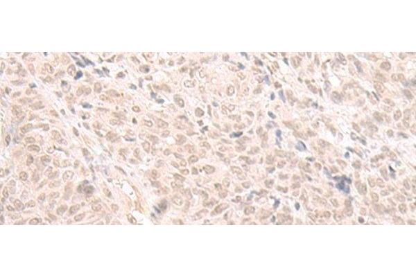 HOOK2 antibody