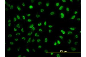 Immunofluorescence of monoclonal antibody to SNAI2 on HeLa cell. (SLUG antibody  (AA 97-169))