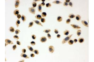 IHC analysis of Peroxiredoxin 3 using anti-Peroxiredoxin 3 antibody . (Peroxiredoxin 3 antibody  (AA 110-256))