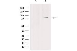 Western blot analysis of extracts from HepG2, using TRI18 Antibody. (MID1 antibody  (N-Term))