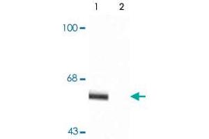 Western blot of rat cortex lysate showing specific immunolabeling of the ~60k - ~62k Syt1 phosphorylated at Thr202 (Control).