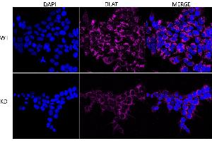 Immunocytochemical staining of HeLa cells using DLAT antibody (ABIN7798336), 1:1,000), Top panel: wild-type (WT), Bottom panal: DLAT shRNA knockdown (KD). (Recombinant DLAT antibody)