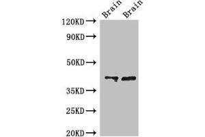 Western Blot Positive WB detected in: Rat brain tissue, Mouse brain tissue All lanes: CAMK1 antibody at 3 μg/mL Secondary Goat polyclonal to rabbit IgG at 1/50000 dilution Predicted band size: 42 kDa Observed band size: 42 kDa (CAMK1 antibody  (AA 166-265))