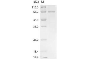 (Tris-Glycine gel) Discontinuous SDS-PAGE (reduced) with 5 % enrichment gel and 15 % separation gel.