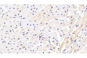 Detection of IL1RAPL1 in Human Cardiac Muscle Tissue using Polyclonal Antibody to Interleukin 1 Receptor Accessory Protein Like Protein 1 (IL1RAPL1) (IL1RAPL1 antibody  (AA 113-276))