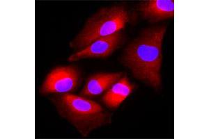 Immunofluorescence of human A-549 cells stained with Hoechst 33342 (Blue) and NAT6 monoclonal antibody, clone AT2F4  (1 : 500) with Texas Red (red). (NAT6 antibody  (AA 1-308))