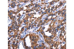 Immunohistochemistry (IHC) image for anti-Growth Regulation By Estrogen in Breast Cancer 1 (GREB1) antibody (ABIN2433111)