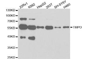 Western blot analysis of extracts of various cell lines, using TMPO antibody (ABIN5971365) at 1/1000 dilution. (Thymopoietin antibody)
