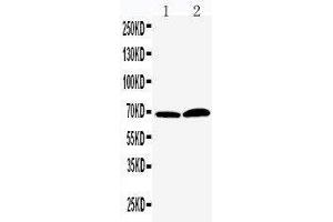 Anti-PADI4/PAD4 antibody, Western blotting Lane 1: PANC Cell Lysate Lane 2: 293T Cell Lysate (PAD4 antibody  (Middle Region))