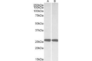 AP21291PU-N UCHL1 antibody staining of Mouse (A) and Rat (B) Brain lysates at 0.