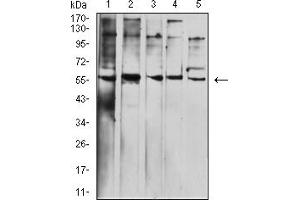 Western Blotting (WB) image for anti-Butyrophilin, Subfamily 1, Member A1 (BTN1A1) (AA 27-242) antibody (ABIN7193239)