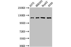 Western Blot Positive WB detected in: A375 whole cell lysate, HEK293 whole cell lysate, HepG2 whole cell lysate, A549 whole cell lysate All lanes: FARP1 antibody at 3 μg/mL Secondary Goat polyclonal to rabbit IgG at 1/50000 dilution Predicted band size: 119, 123, 15 kDa Observed band size: 119 kDa (FARP1 antibody  (AA 1-300))