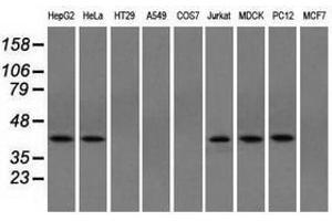 Image no. 4 for anti-Acetyl-CoA Acetyltransferase 2 (ACAT2) antibody (ABIN1496402) (ACAT2 antibody)