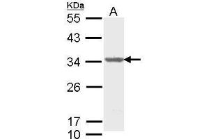 WB Image Sample (30 ug of whole cell lysate) A: Molt-4 , 12% SDS PAGE antibody diluted at 1:1000 (THO Complex 4 antibody)