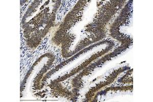 IHC analysis of SMAD2 using anti-SMAD2 antibody (ABIN7602542).