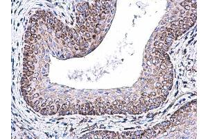 IHC-P Image COX5A antibody [N1C3] detects COX5A protein at mitochondria on mouse cervix by immunohistochemical analysis. (COX5A antibody  (Center))