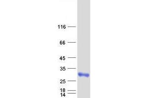 Validation with Western Blot