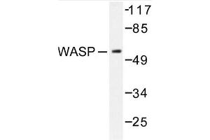 Image no. 1 for anti-Wiskott-Aldrich Syndrome (Eczema-thrombocytopenia) (WAS) antibody (ABIN272092) (WASP antibody)