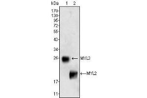 Western Blot showing MYL3 (1) and MYL2 (2) antibody used against rat fetal heart tissues lysate.