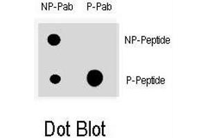 Dot blot analysis of CDKN1A (phospho T145) polyclonal antibody  on nitrocellulose membrane. (p21 antibody  (pThr145))